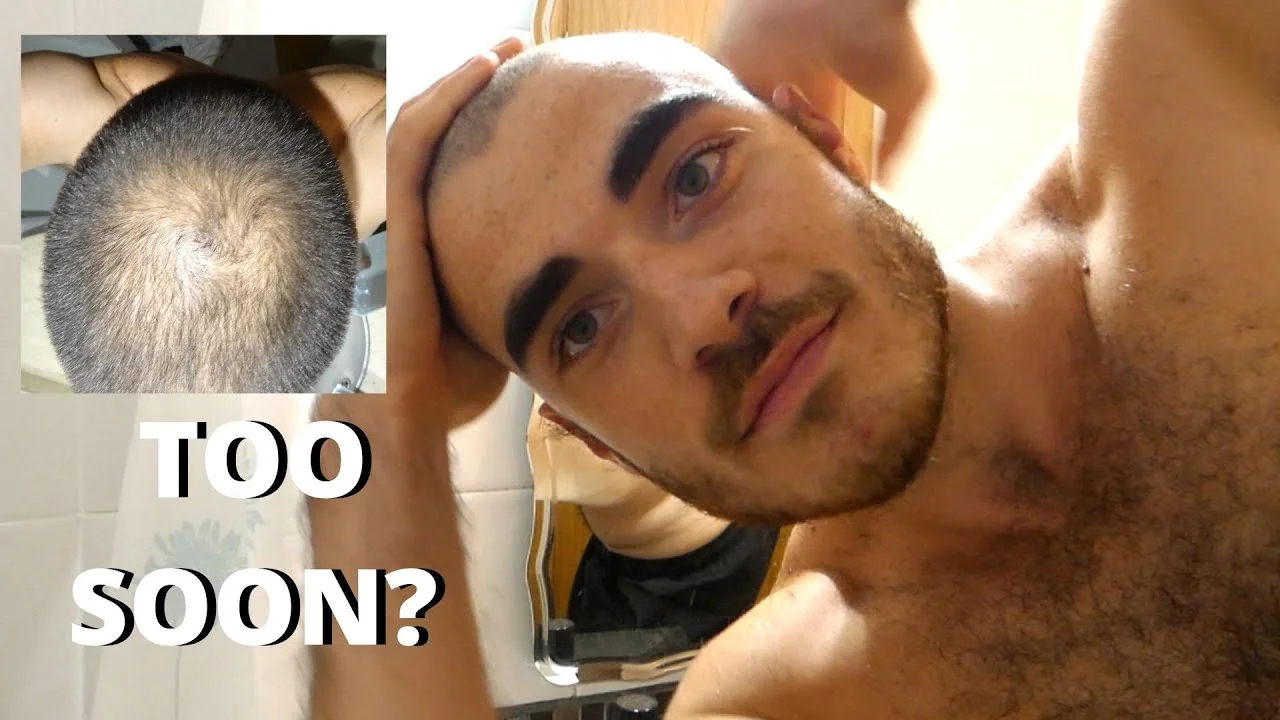 Go bald or go home LA cinema offers free Bugonia t 20251020 150200