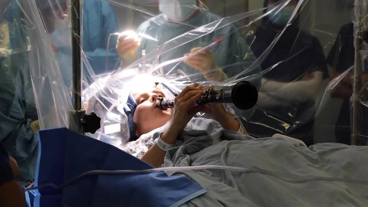 Woman plays clarinet during four hour brain surger 20251022 063619