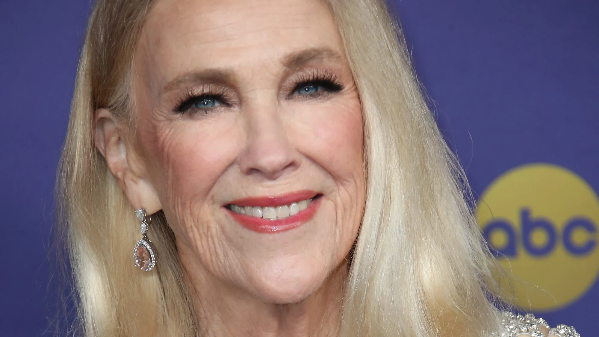 Catherine OHara revealed she had rare genetic cond 20260201 023726
